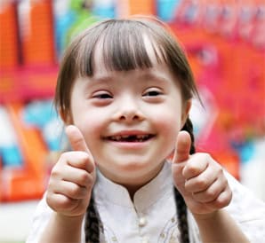 Little girl with special needs holding two thumbs up